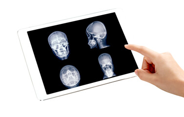 Poster - A hand points at a tablet screen showing  skull X-ray images isolated on a white background with a clipping path.