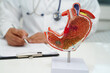 © manassanant - Stomach disease, doctor holding anatomy model for study diagnosis and treatment in hospital.