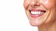 © Olga - Laughing woman mouth with beautiful healthy white teeth on a white background. Place for text