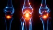 © Dackshina - Joint pain or knee injury medical autonomy orthopedic inflammation image diagnosis red glowing pain mark