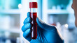 © Sonya - A hand in a medical glove holds a test tube with blood against the background of a laboratory.