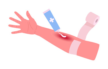 Wall Mural - cartoon injured hand. first aid for body skin burn, medical treatment for arm injury flat vector ill