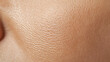 © Oksana_Latysheva - Human skin texture