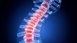 © Eva - Premature Spinal Disc Degeneration 3D Render of a Young Adults Spine with Visible Damage