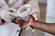 © Seventyfour - Top view closeup of dermatologist carefully inspecting arms of unrecognizable patient in clinic and using magnifying glass copy space