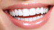 © AdamDiezel - close-up of a radiant, perfect white smile with gleaming teeth, bright and healthy