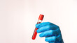 © Антон Скрипачев - A person is holding a red blood sample in a plastic tube. The tube is in a blue glove