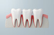 © piyaset - gum disease by gingivitis, gum redness and swelling. 3D rendering.