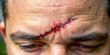 © VisualVault - A close-up image of a man's forehead with a fresh, bloody gash, revealing the raw pain and vulnerability of an injury.