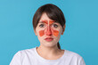 © New Africa - Woman suffering from sinusitis on light blue background. Illustration on her face showing disease