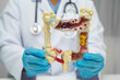 © kanruthai - Intestine, doctor holding human anatomy model for study diagnosis and treatment in hospital.