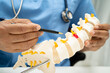 © kanruthai - Asian doctor holding spinal nerve and bone model, Lumbar spine displaced herniated disc fragment for treatment medical in the orthopedic department.
