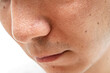 © Taro - いちご鼻のクローズアップ：30代男性の毛穴と角栓