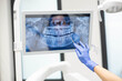 © Dejan - A dentist in blue gloves uses a dental tool to point at a specific area on a digital dental X-ray, conveying an explanation or assessment in a clinical setting.