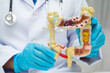 © kanruthai - Intestine, doctor holding human anatomy model for study diagnosis and treatment in hospital.