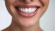 © lukshan - Close-Up of a Woman's Smile with Perfectly White Teeth