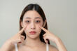 © Pormezz - lack of sleep problem, Worried Asian young woman pointing finger at dark circles under her eyes