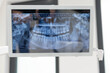 © Dejan - An x-ray image of teeth is shown on a screen in a dental office, helping dentists evaluate a patient's dental health for accurate diagnosis and treatment planning.