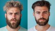 © ECLIVN - Two portraits of young Caucasian men with full beards, showcasing different hairstyles against a vibrant blue background., contrast of hair style, comparison