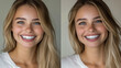 © MdAl - Close-up portrait of a woman smiling confidently, showcasing before-and-after teeth whitening treatment