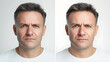 © gnoparus - Man's Serious Face, Before & After, Portrait, Facial Expression