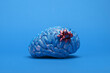 © SOLDATOOFF - Blue brain with a gift bow on a plain blue background. Symbolizing 'Blue Monday' the saddest day of the year, with a hint of irony