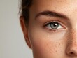 © Creator88 - Closeup of freckles on a woman s face, natural beauty, pure and youthful skin
