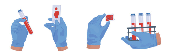 Blood tube analysis. Bloods filling glass vial tubes in nurse hands gloves for medical hiv or diabetes test, biochemistry chemical lab experience testing vector illustration