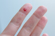 © Svetlana - Close-up of a woman's hand with a cut on finger with a little blood