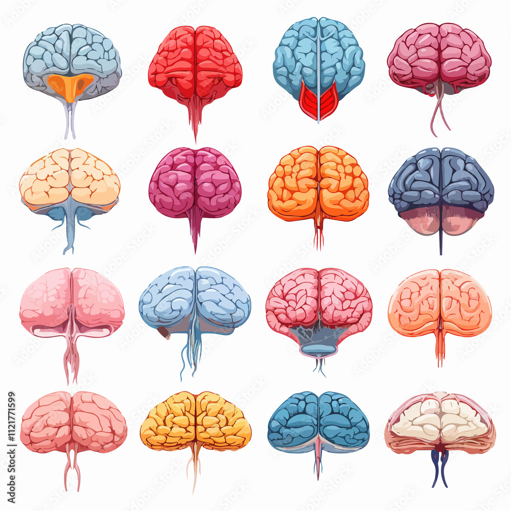 Detailed guide to human brain stroke types and illustrations Stock ...