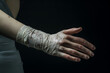 © Tetiana - Generated AI picture of injured bandaged hand broken arm or fingers generative ai
