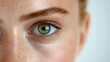 © Raul - Close-up of a young Caucasian woman's striking green eye with freckles and soft skin tone.
