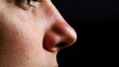 © yang - Close up of red irritated nose, emphasizing the discomfort and struggle of allergies or cold symptoms, highlighting the human vulnerability and resilience in the face of common ailments.