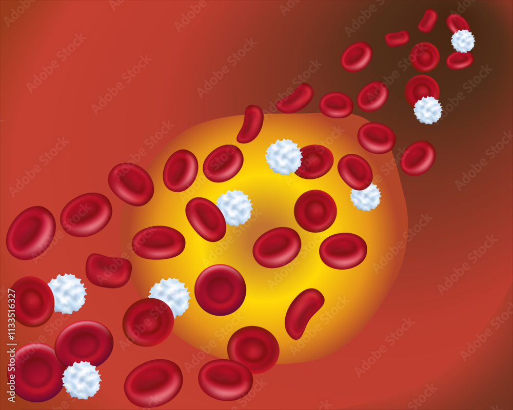Healthy human red and white blood cells in an artery. Cholesterol ...