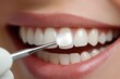 © Olha - A dental hygienist cleaning teeth before a professional whitening session.