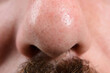 © Niko_Dali - Detailed macro shot of a man's nose, showcasing skin texture and pores.  Dark mustache hairs are visible below the nostrils.