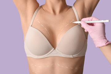 Wall Mural - Plastic surgeon marking woman's breast on lilac background, closeup