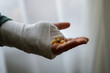 © Natali - Close-up of a hand in a plaster cast, holding a bunch of soft-shell capsules