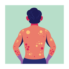 Skin conditions vector illustration