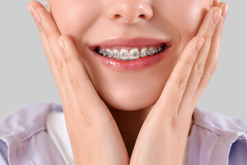 Wall Mural - Young woman with dental braces smiling on light background, closeup