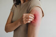 © Nida - Woman scratches irritated arm, drawing attention to discomfort and skin sensitivity
