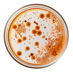 Poster - Petri dish showing growing orange bacteria colonies