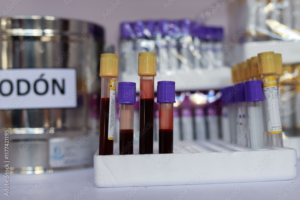 Rack of Blood Samples Ready for Laboratory Testing and Analysis Stock ...