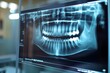 © Sach - Medical, xray and illustration of teeth in mouth for wisdom tooth, growth and dental examination. Anatomy, radiology and dentistry in healthcare with scan for root canal, evaluation, Generative AI