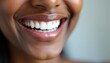 © umut hasanoglu - Close-up of a person's bright, healthy smile.  A radiant expression showcasing beautifully aligned teeth and healthy gums. Perfect for dental, health, and beauty contexts.