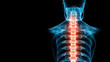 © Pisahouse - X-ray film, A detailed X-ray image showcasing the spinal column, highlighting vertebral structure and alignment, useful for medical professionals and educational purposes.