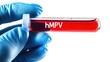 © Ketanoff - A hand in a blue glove holds a test tube labeled hMPV, containing blood. This is part of ongoing research on metapneumovirus in China during 2025