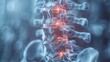 © sorin - 3d illustration of spinal column with implant and screw placement for enhanced stability