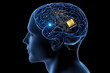 © Phichitpon - Human brain with implanted neural ink chip implanted, Neural connection to computer, Neuro engineering. neural ink concept.
