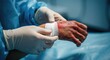© mariiaplo - A nurse or medical professional bandages a severely burned hand, wearing protective gloves in a sterile environment with a focus on patient care.